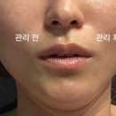수피아 스킨앤바디