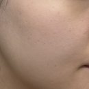 본뷰티컴퍼니 | [뷰티] 약국판매 고함량 PDRN 크림 찾는다면? 리쥬비란 PDRN 5000ppm 리커버리 크림 후기