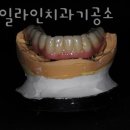 라인 치과기공소 이미지