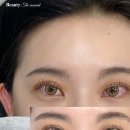 더모먼트 이미지