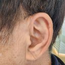 대동 독일보청기 이미지