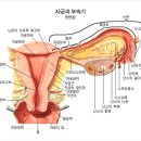 여성질병의 종류/자궁경관염,자궁경부암,자궁근종,자궁내막증 이미지