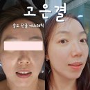 송도 윤곽관리 벌써 3달째 고은결 인천송도점 솔직후기