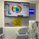 남정시장 | 남대문안경 남정안경 라섹 후 떨어진 시력 블루라이트안경 합리적가격으로 맞춘 후기