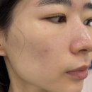 양원역 | 청아온결 망우동 피부관리 피부스케일링 후기 양원역 에스테틱