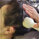 모코드두피탈모센터 이미지