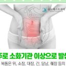 배가 아파요 복통 원인 무엇배 아픈 위치 이미지