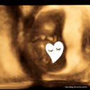 오송우리약국 | 드디어 우리에게도 다시 아가천사가! 영양제 무조건 챙겨먹기 시작 첫번째!! 프리솔라 활성형엽산