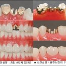 휴먼브릿지 이미지