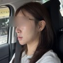 필조명 | 홍대에서 아쿠아필 받고 온 후기 / 홍대입구역 피부과