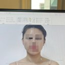 효진빌딩 | 강남피부관리 논현역 윤곽관리 클리니스킨 강남본점 비대칭관리 후기