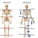 올바른체형관리