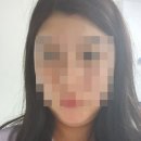윤곽주사패키지 1회차 후기_청담동피부과추천 모즈클리닉
