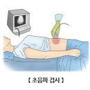 검사/시술/수술정보 이미지