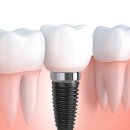 고호치과의원 이미지