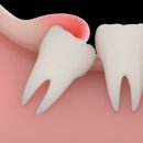 퍼스트사랑니치과의원 이미지