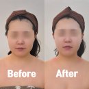 도자기까페D토 | 배곧피부샵, 배곧웨딩관리 윤곽관리 맛집 페이스펙, 숨은 턱 라인 찾아옴!