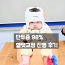 하니네 | 아기 두상 사두 단두 하니헬멧 제작 후기 애개육아
