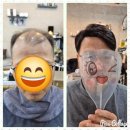 에띠모가발