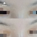 아동건강 관리센터 | 🇨🇭스위스익스필 아동·청소년 피부건강 전문센터