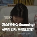 지(G) | 지스캐닝(G-Scanning) 후기 | 선택적 검사, 꼭 필요할까?