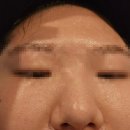 김포 앉아서 살빼는 온열테라피 찜질다이어트 고촌따숨다이어트