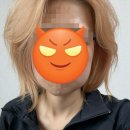 뽑고 또 뽑고 | 하악 매복사랑니 양쪽 뽑고 먹고싶은거 다먹은 자의 후기(멍,붓기,통증,비용 등 )