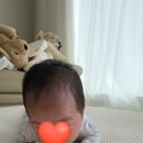 2024.09 수원 아주대 사경 사두치료 예약 및 진료비, 진료횟수, 재활 치료비 (아이 두상 이쁘게 하기)