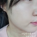 광채피부 쿨링쿠션 추천 더마에임 더마글로우 쿠션 솔직 후기