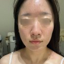 양산 / 지니아스킨 양산피부관리 양산에스테틱추천