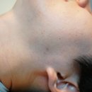 아누비스 트러블 롤온 쓱쓱 바르기 편한 트러블스팟 제품 추천