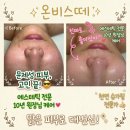 잰에스테틱 | 두정동 에스테틱 온비스떼 블랙필 후기! 데콜테 손맛 예술인 두정동 피부관리 천안 여드름관리 추천