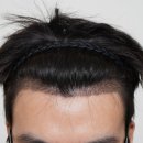 바람부는날에도 성형외과의원 이미지