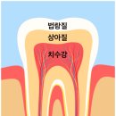 우리부부치과 네이버블로그