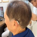 중도마을회관 | 노원보청기 어르신 오픈형으로 편안하게 착용한 후기!