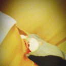 운중경희한의원 | 한의원 추천!!! - 운중 경희 한의원 ★ - [분당 서판교 운중동 한의원/운중동 한의원/운중 경희한의원]