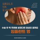 덕계베스트치과의원 | 덕계역치과 임플란트 멍 수술 후 턱 주변에 생겼다면 정상인 걸까요