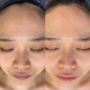 정관롯데캐슬 | 정관 피부관리 추천 "올가드림뷰티 정관롯데캐슬점" 모공디톡스 물광피부 후기