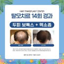 모수테라피