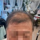 루아헤어&가발 이미지