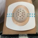 안다찌 | 상처보호 필수템 안다찌 DIY 상처보호캡 사용후기