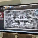 감일어린이치과의원 이미지