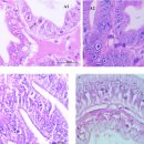 흰다리새우의 흰똥병(white gut syndrome, WGS)유사 Wenzhou shrimp virus 8 (WzSV 8) 이미지