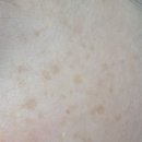 아르페 | 아르페 기미패치 후기｜마이크로니들패치로 잡티 집중 홈케어 사용기