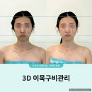 수원-0106 | 수원 얼굴경락 고운빛깔 에스테틱 비대칭 관리 후기