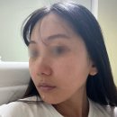 청주피부관리 산남동마사지 스킨스토리 에스테틱 톤업 리프팅 각질관리 수분관리 받은 후기