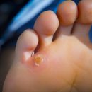 발아정형외과의원 이미지