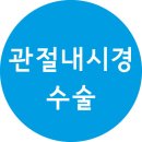 #전방 십자인대파열 #관절내시경 #십자인대수술 #전방십자인대 #십자인대 이미지