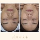 희메디칼 이미지