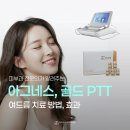 수원 여드름 피부과 아그네스, 골드PTT 치료방법과 효과